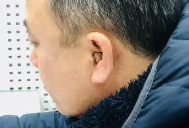 Máy trợ thính đeo trong tai CIC – Hiện đại, nhỏ gọn, thẩm mỹ